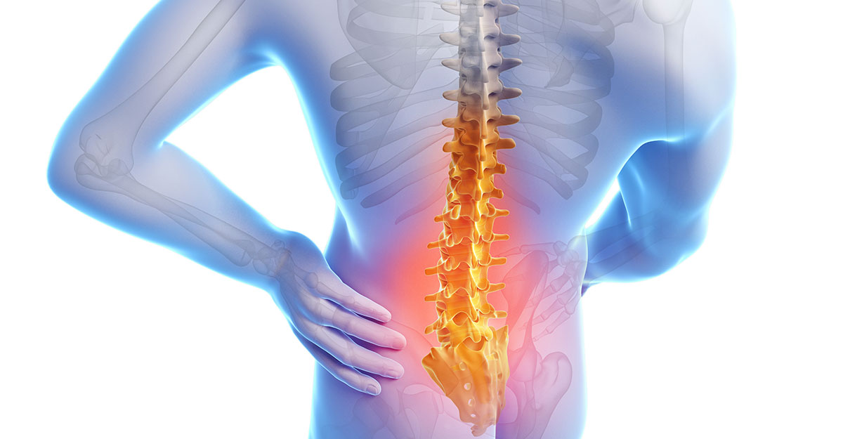 Kettering back pain treatment by Dr. Poelking