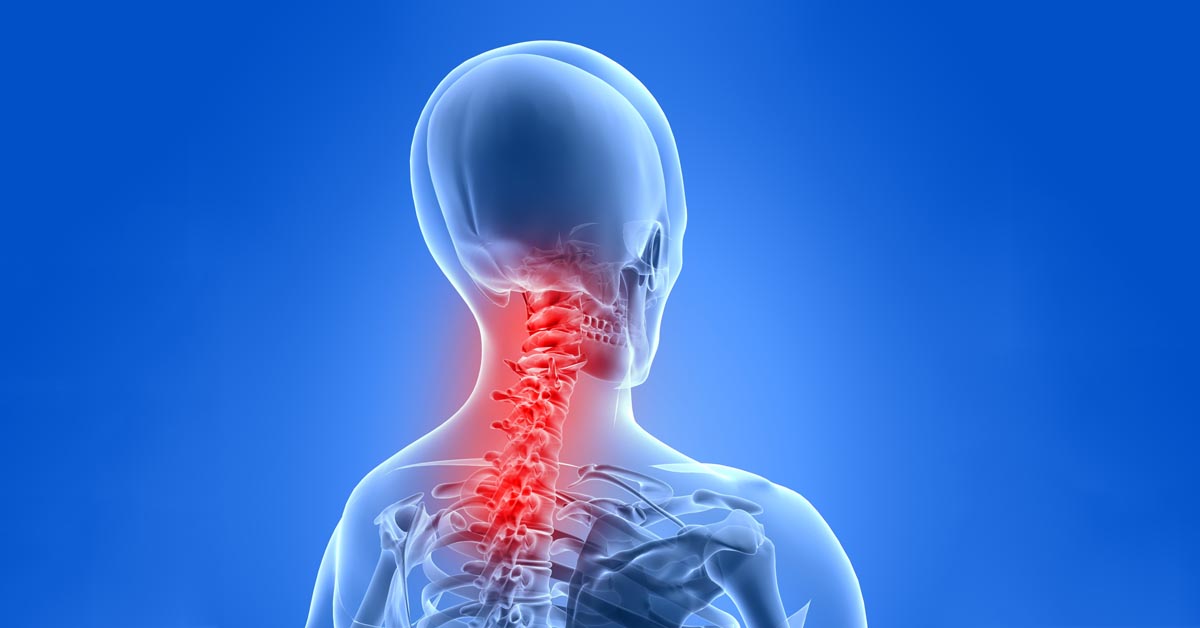 Kettering car accident and neck pain treatment